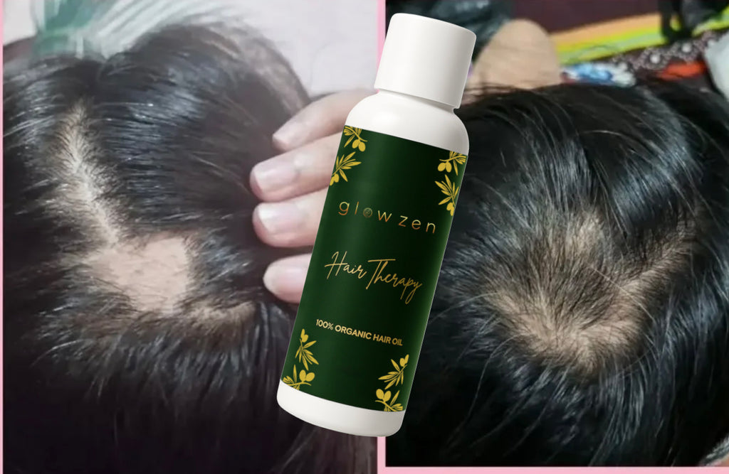 Hair Therapy by Glowzen Beauty